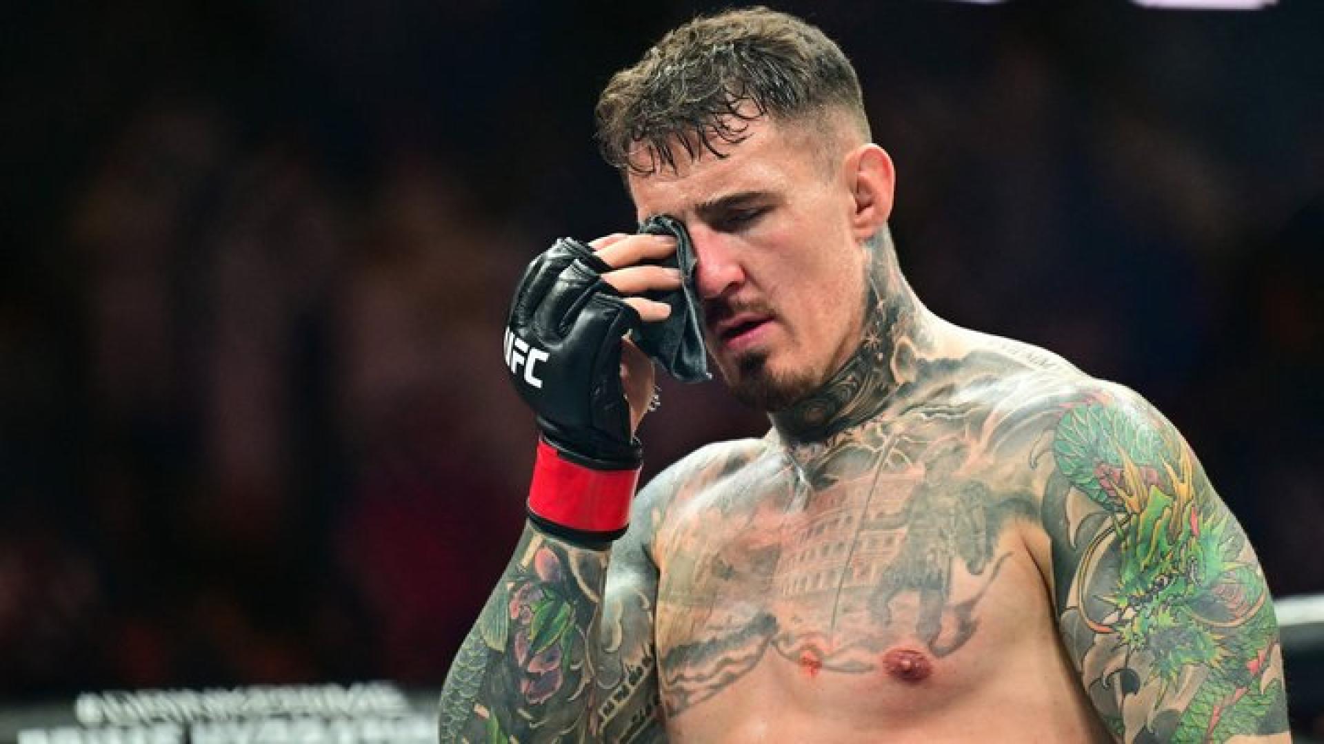 Аспиналл из-за травмы может не вернуться в октагон UFC