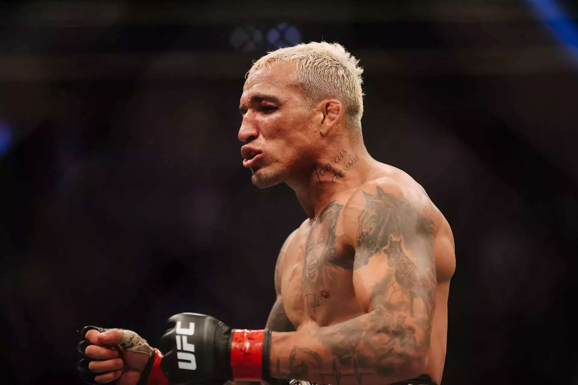 «Я мог остаться парализованным»: Чарльз Оливейра раскрыл детали ужасной травмы